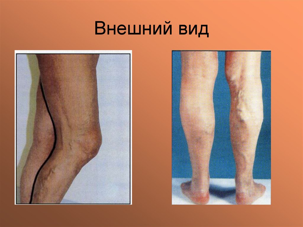 Внешний вид