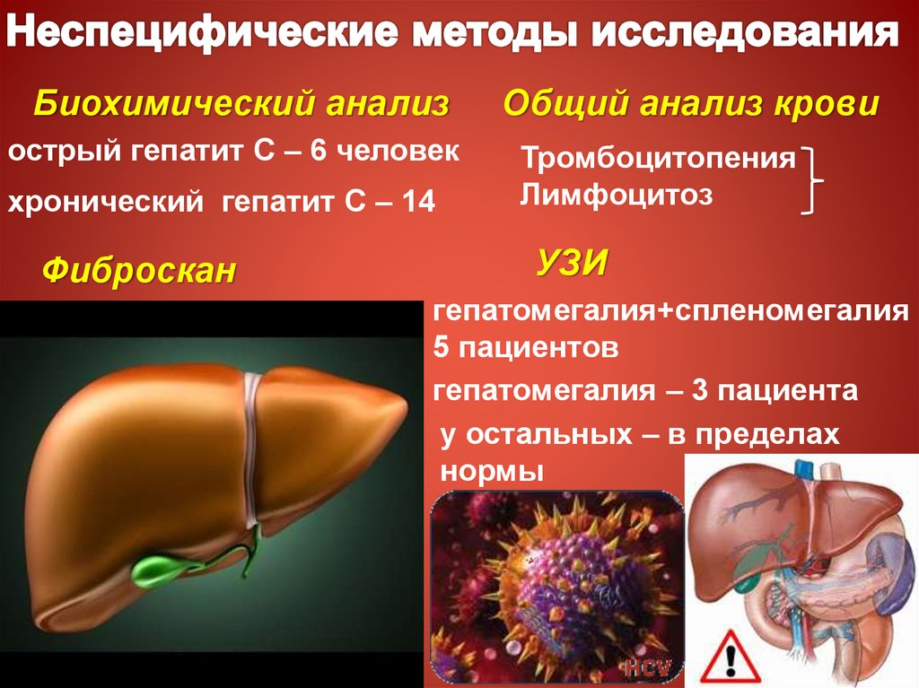 Операция при гепатите с