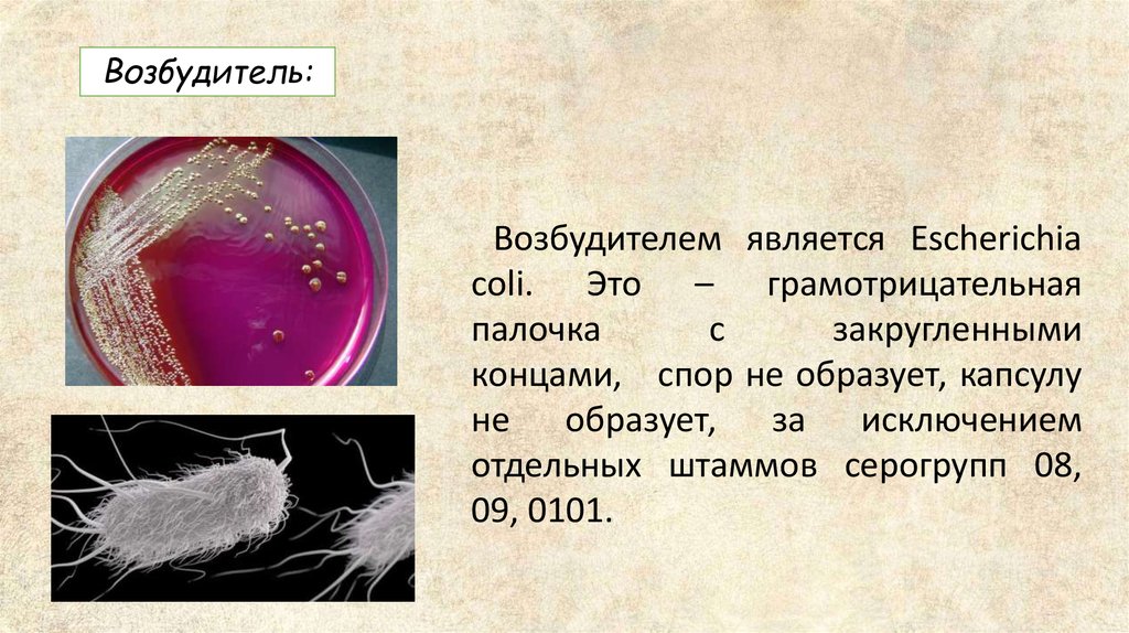колибактериоз - презентация онлайн
