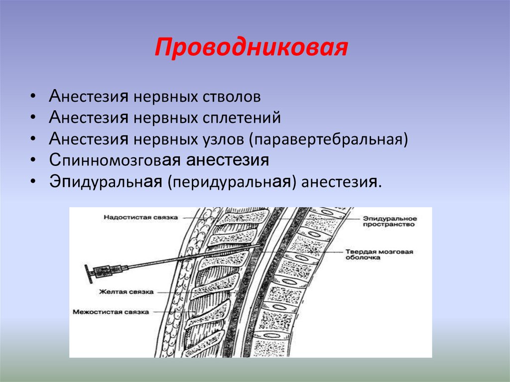 Проводниковая анестезия презентация