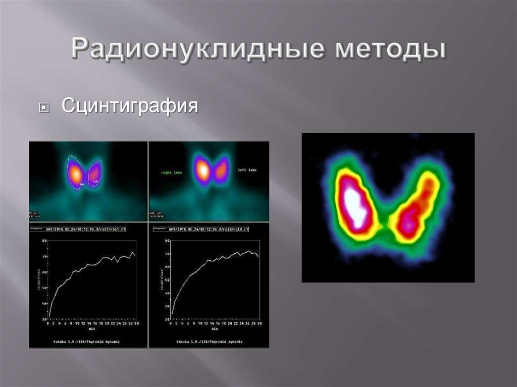 Радионуклидная диагностика. Радионуклеидные методы. Радионуклииднвп методы. Радионуклидное исследование. Радионуклидные методы физиологии.