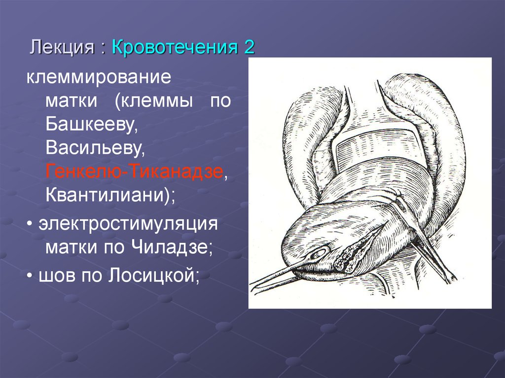Лекция : Кровотечения 2