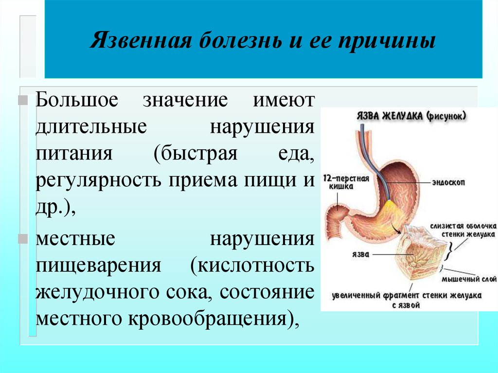 Язвенная болезнь желудка у детей