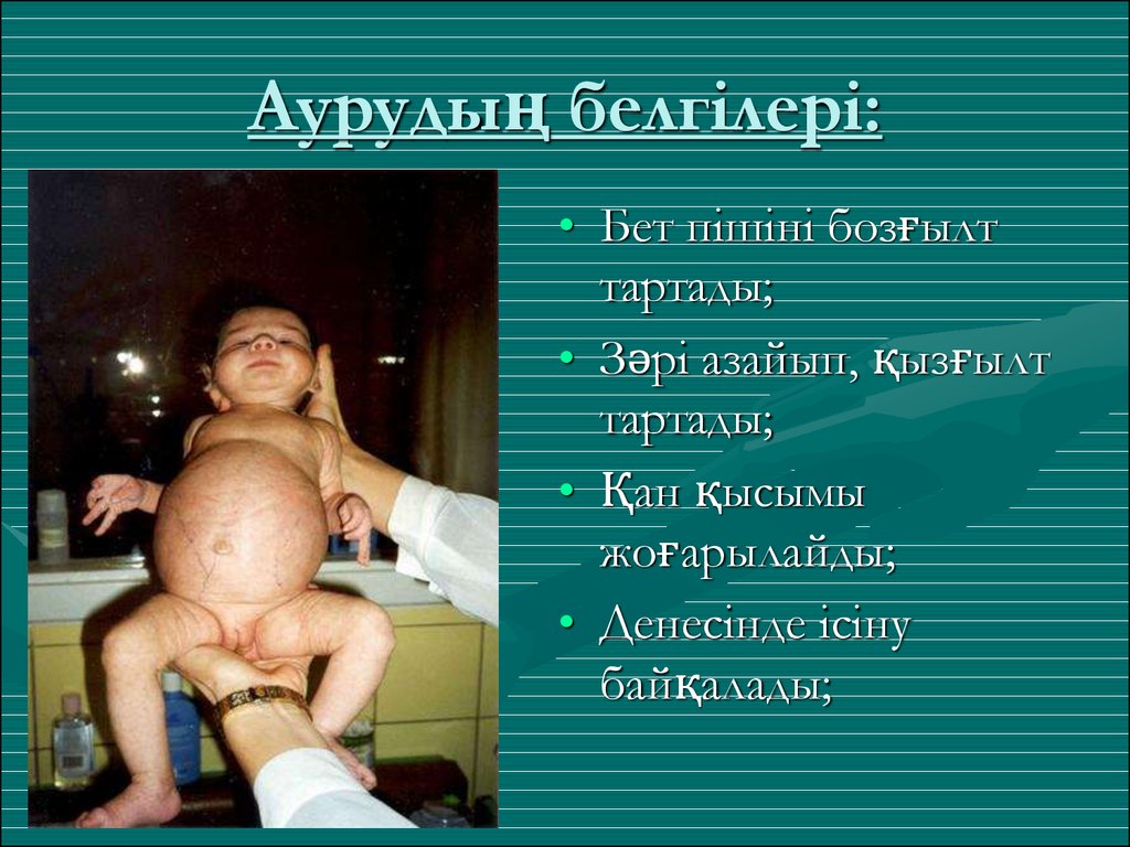 Аурудың белгілері: