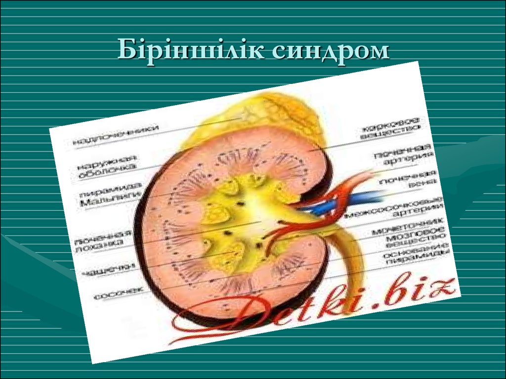 Біріншілік синдром