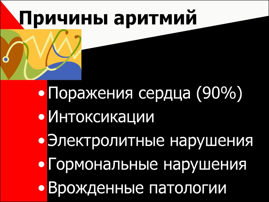 Причины аритмий