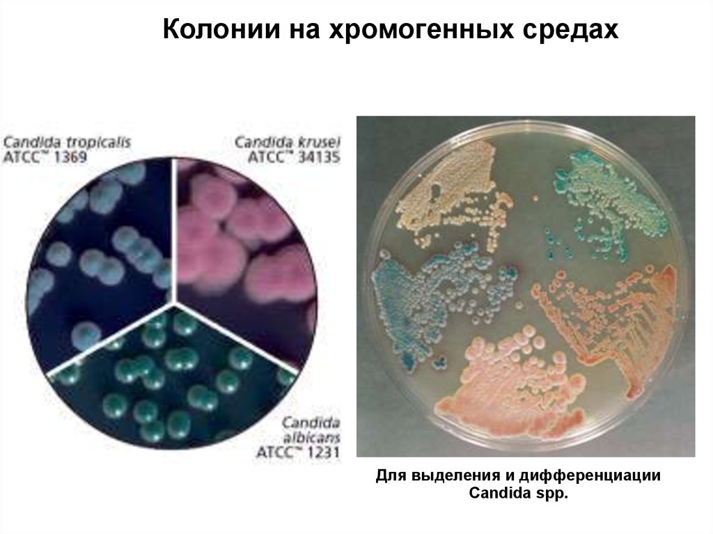 Candida spp. Колонии на хромогенных средах. Хромогенная среда Candida. Кандида лабораторная диагностика.