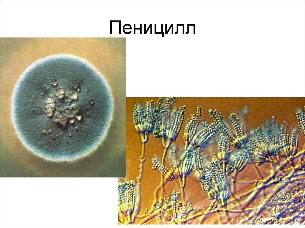 Пеницилл группа организмов. Плесневелый гриб пеницилл. Плесневые грибы пенициллин. Одноклеточные грибы пеницилл. Плесень пеницилл под микроскопом.