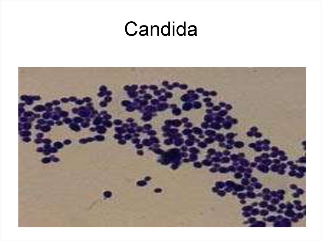 Соскоб на кандид. Кандида микроскопия. Кандида альбиканс микроскопия. Кандида альбиканс мазок. Candida albicans микроскопия.