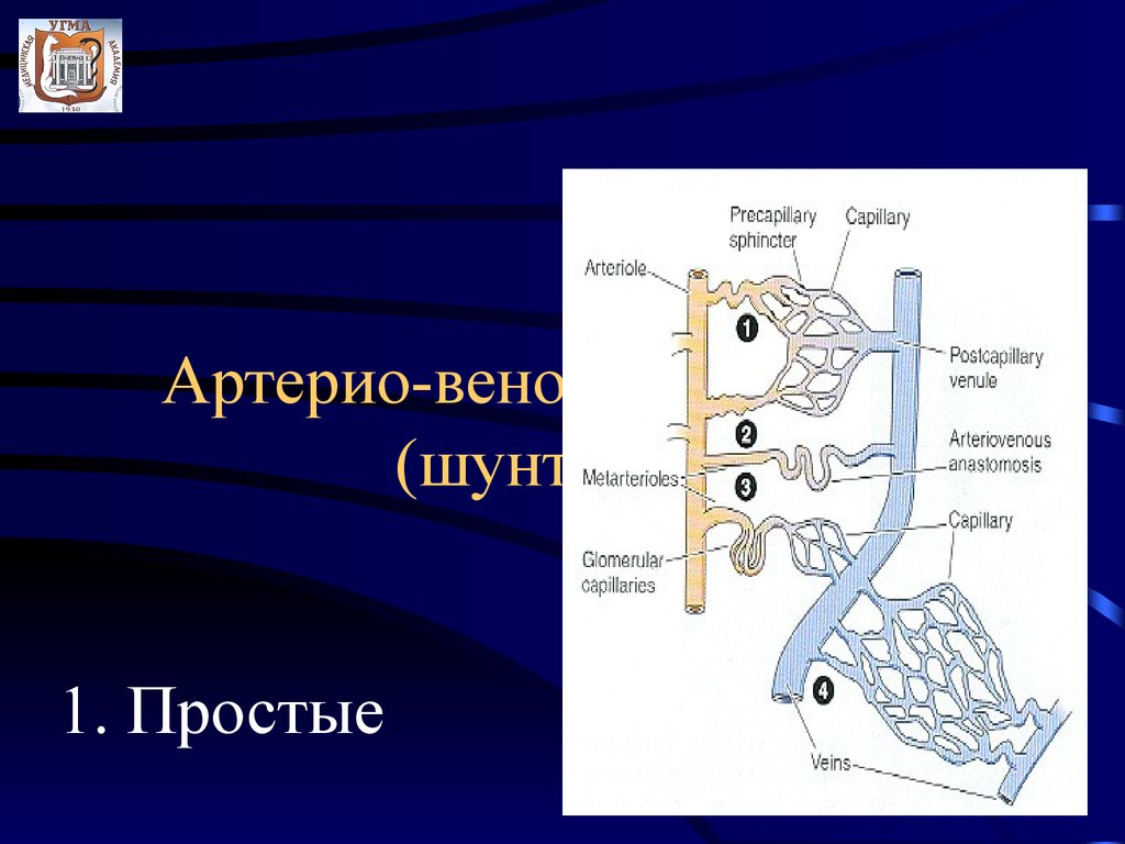 Артериовенозный шунт. Артериовенозные шунты в печени. Артериовенозные анастомозы. Артериовенозные шунты в печени на кт.