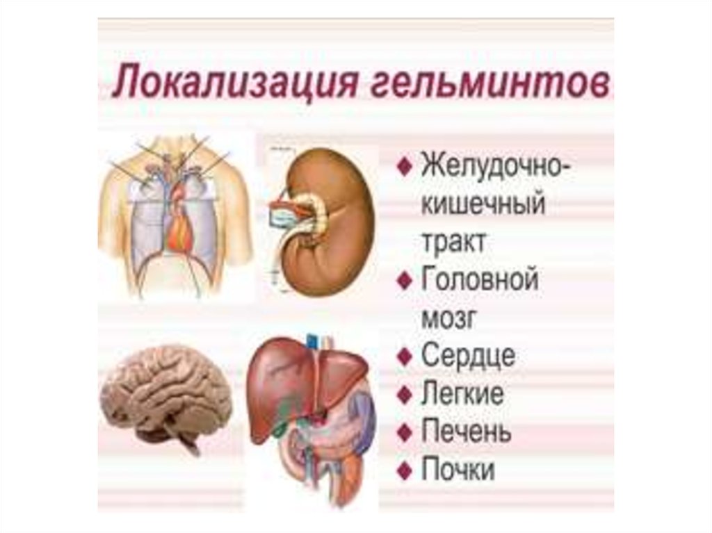 Рассмотрите рисунок на котором изображен взрослый паразитический червь укажите