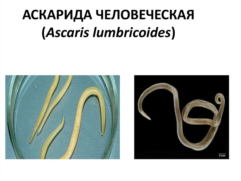 К какому типу животных относят аскариду. Ленточные черви белая аскарида. Круглые черви (аскариды) раздельнополые..
