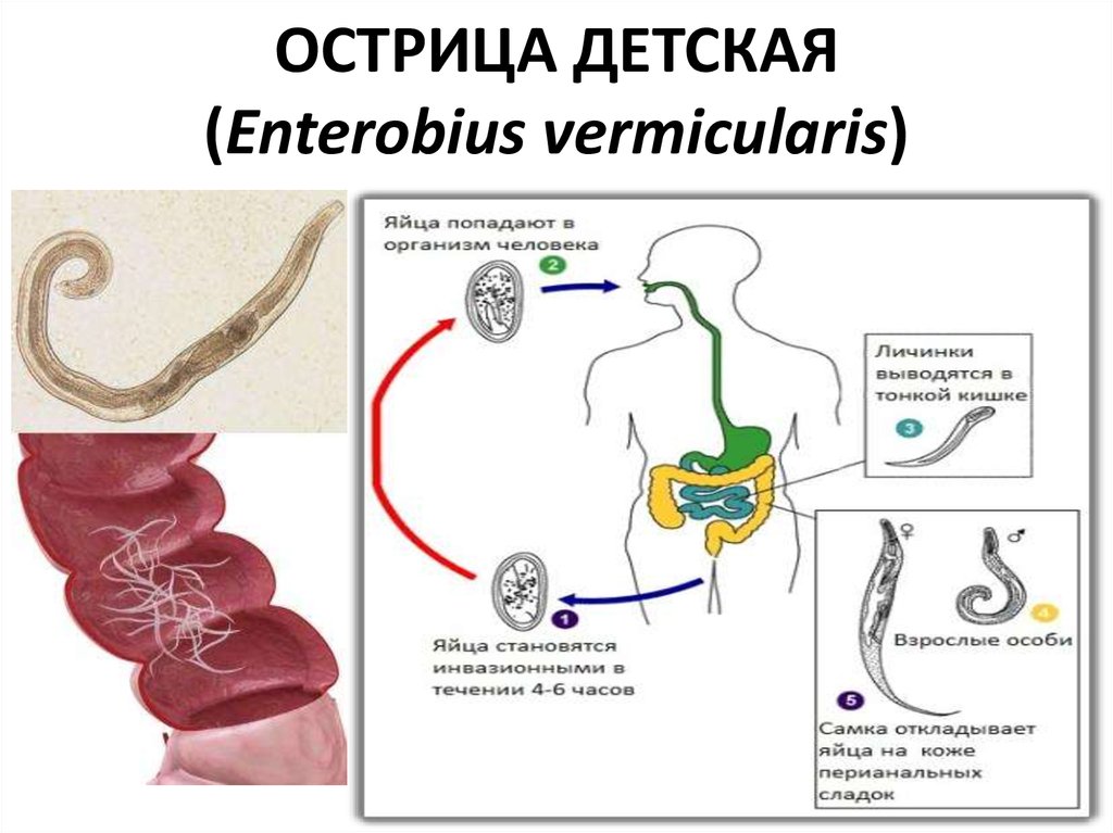 Острицы у детей лечение. Enterobius vermicularis жизненный цикл. Острица детская Enterobius vermicularis. Enterobius vermicularis строение.