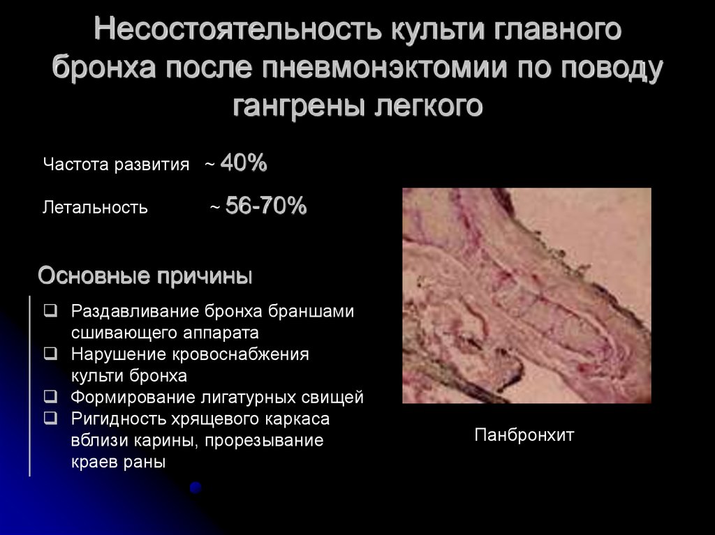 Несостоятельность остиального клапана бпв