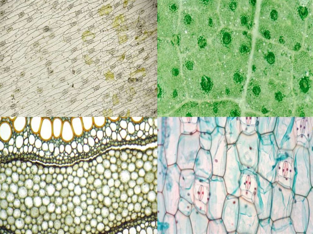 Рисунок видов растительных тканей. Растительные ткани биология. Устьица чечевички гидатоды. Ткани растительной клетки. Ткань в клетку.