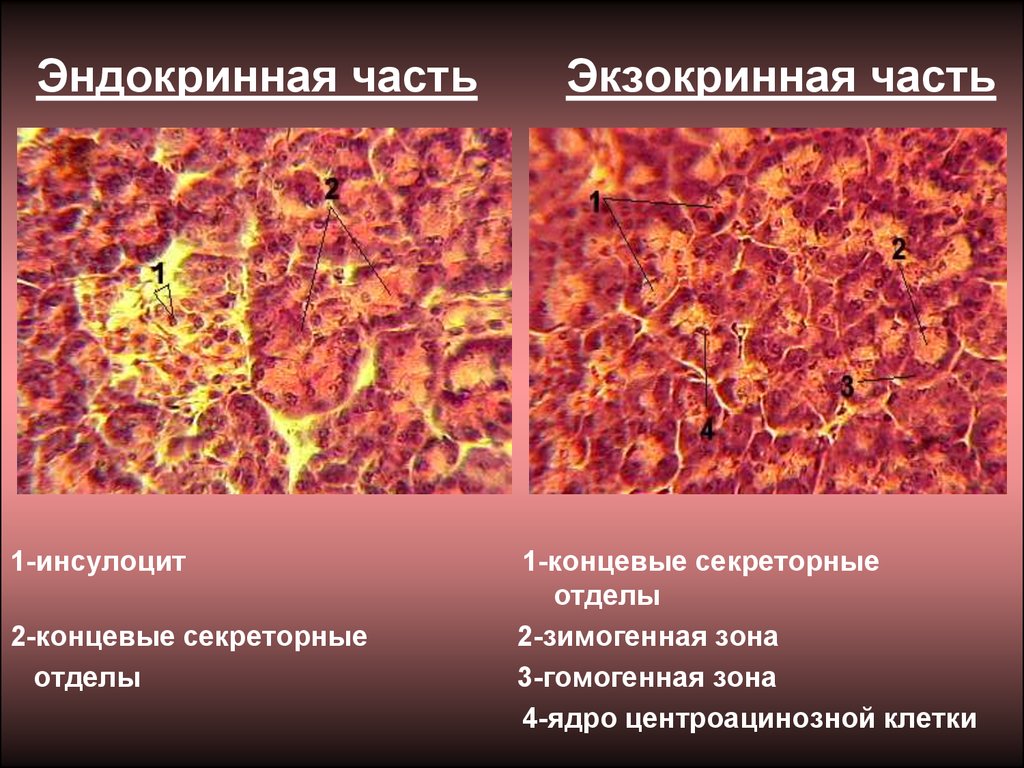 Препарат железа печень. Железы поджелудочной железы гистология. Экзокринная и эндокринная часть поджелудочной железы. Экзокринная система поджелудочной железы. Экзокринный отдел поджелудочной железы гистология.