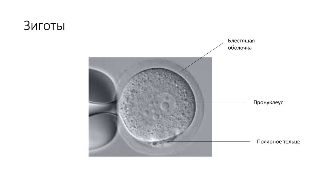 Яйцеклетка бластула гаструла ланцетника. Пронуклеус зиготы. Схема последовательных стадий дробления зиготы:. Стадии развития эмбриона бластула. Гаструла нейрула органогенез.