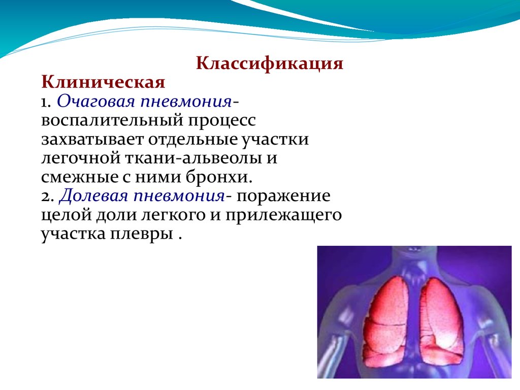 Пневмония у детей картинки для презентации