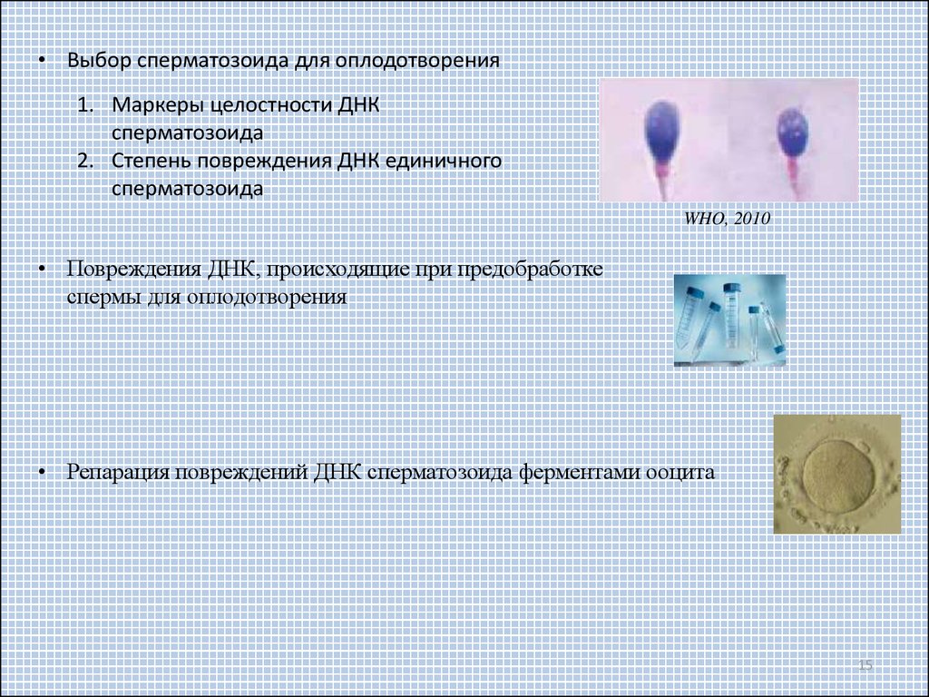 Анализ на фрагментацию ДНК сперматозоидов - клиника Геном в Калининграде
