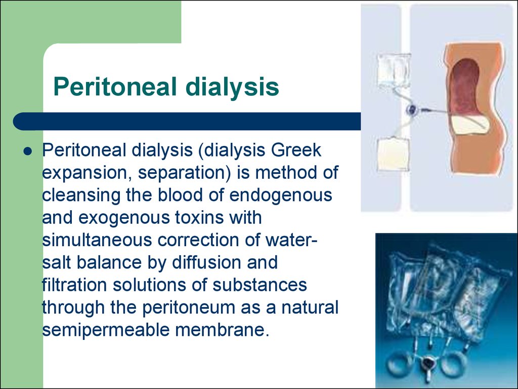Peritoneal dialysis.