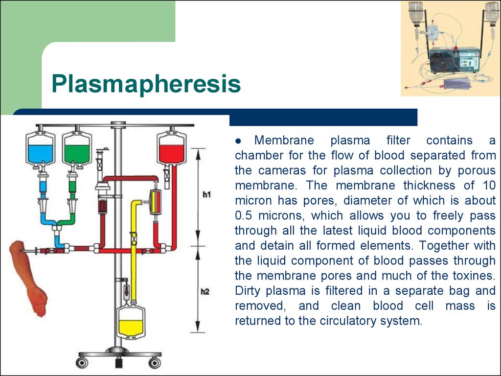 Плазма фильтр. Aminco Separator Blood.