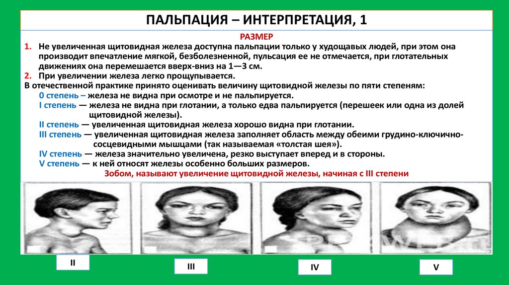 По степени увеличения. Пальпация щитовидной железы в норме. Осмотр и пальпация щитовидной железы в норме. Пальпация щитовидной железы пропедевтика. Классификация пальпации щитовидной железы.