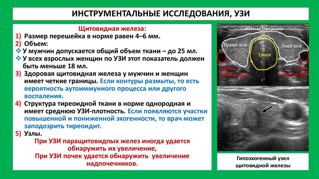 Норма щитовидной железы. Нормы исследования щитовидной железы УЗИ. Норма параметров щитовидной железы на УЗИ. УЗИ щитовидной железы показатели нормы таблица. Норма параметров при УЗИ щитовидной железы.