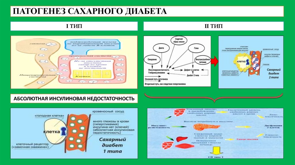 Схема сахарного диабета