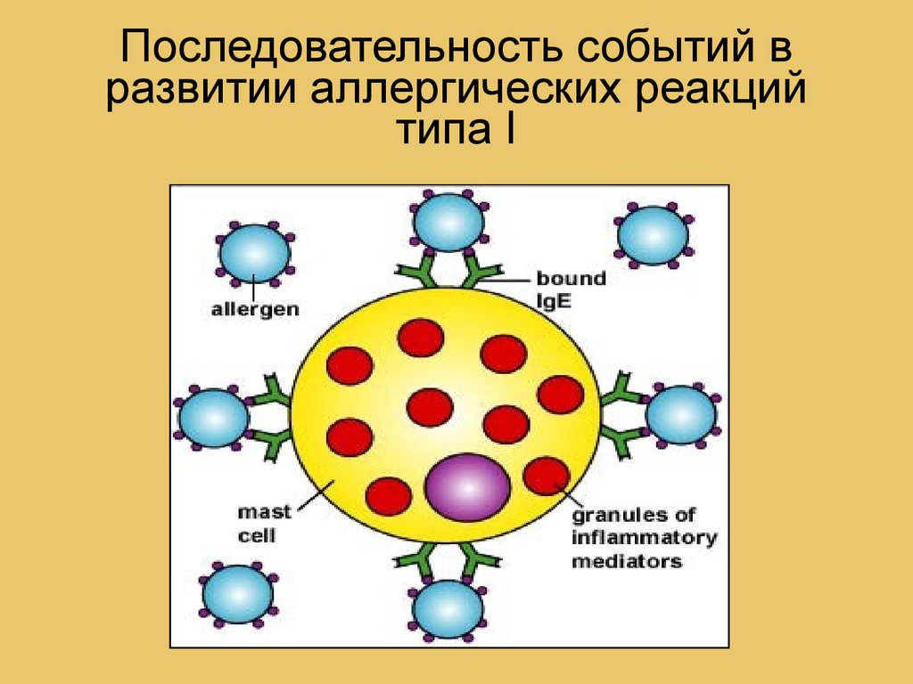 Типы аллергических реакций. Схема аллергической реакции 1 типа. Упрощенная схема аллергической реакции. Схема гиперчувствительности 1 типа. Аллергическая реакция 1 типа.