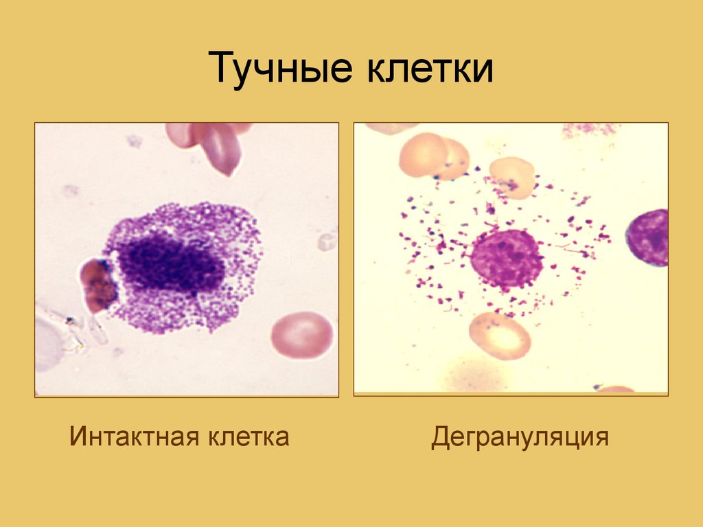 Тучные клетки рисунок