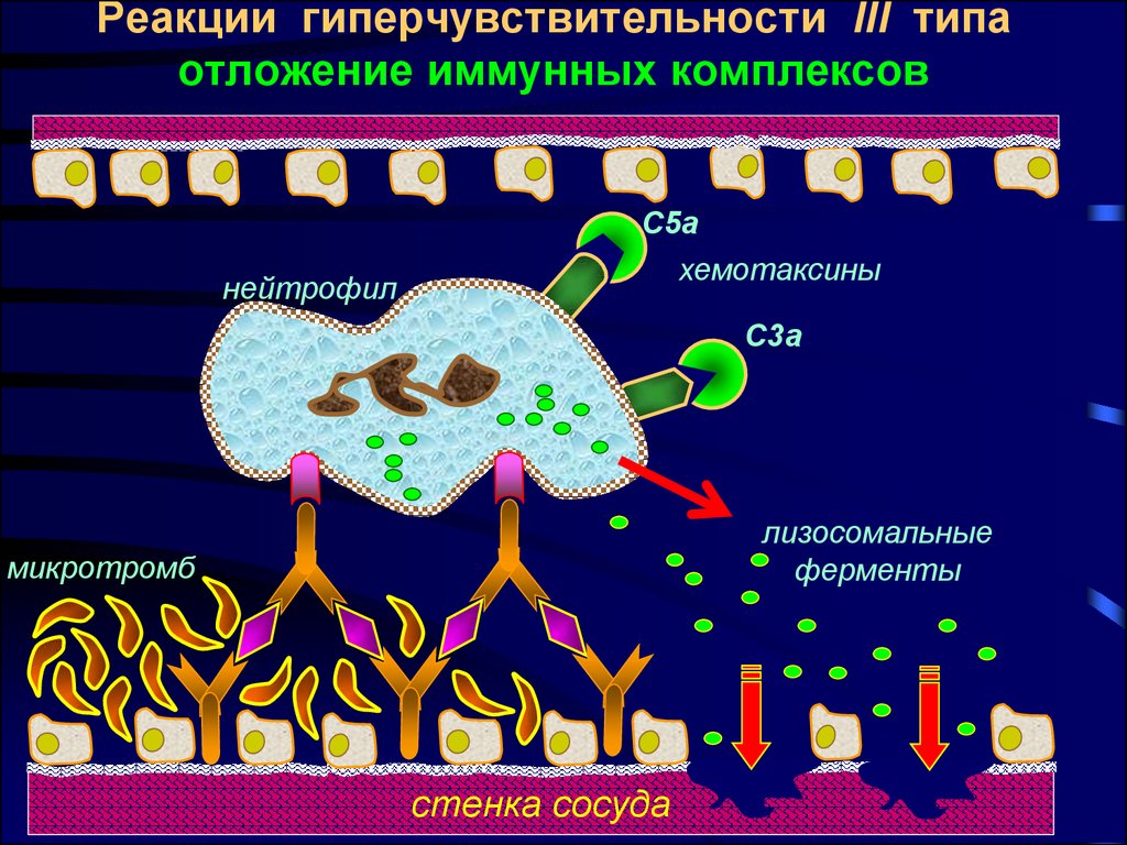 Реакция на третью. Реакция гиперчувствительности 3 типа. Иммунокомплексный Тип гиперчувствительности. Схема реакции гиперчувствительности 3 типа. Реакции гиперчувствительности 3 типатипа.