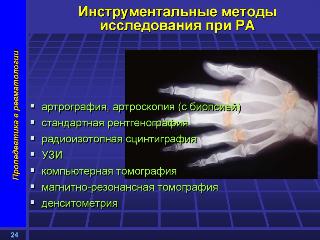 Методы исследования костно мышечной системы презентация