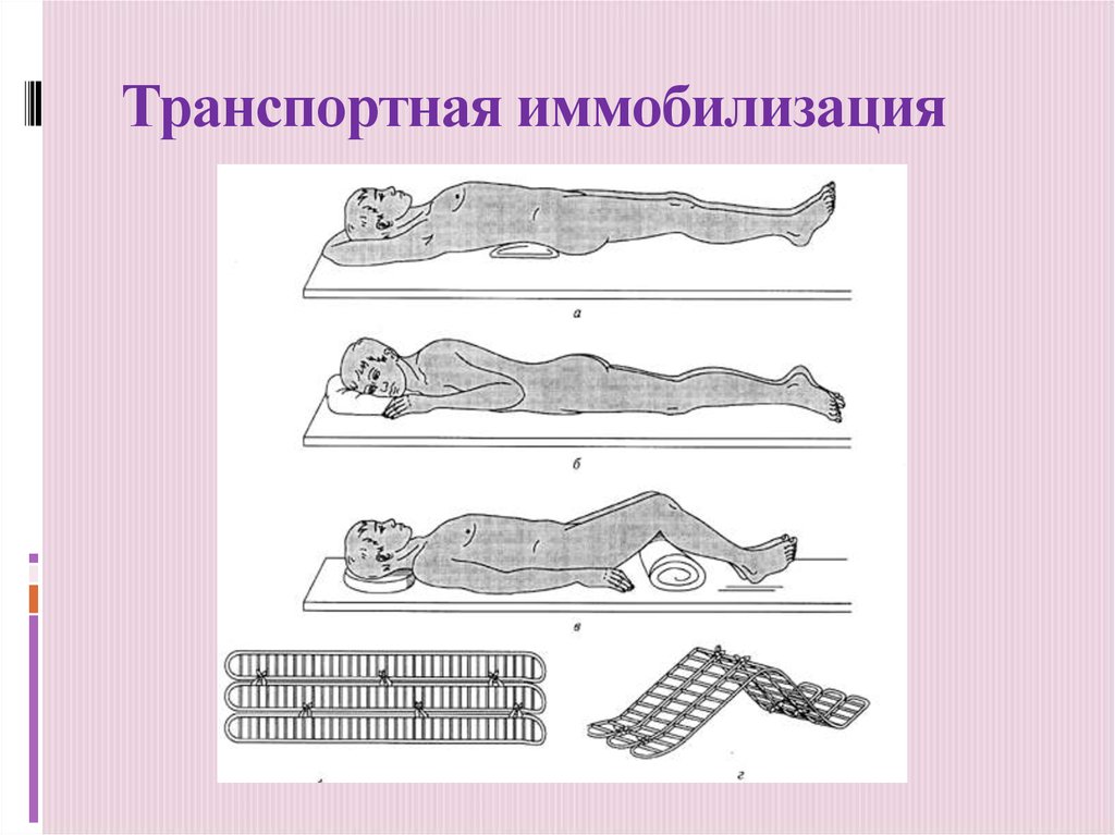 Презентация на тему иммобилизация и транспортировка пострадавших