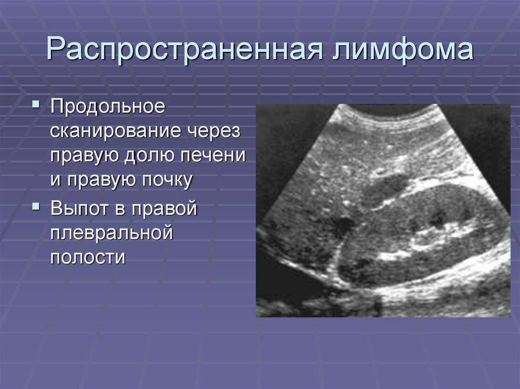 Селезенка беременность