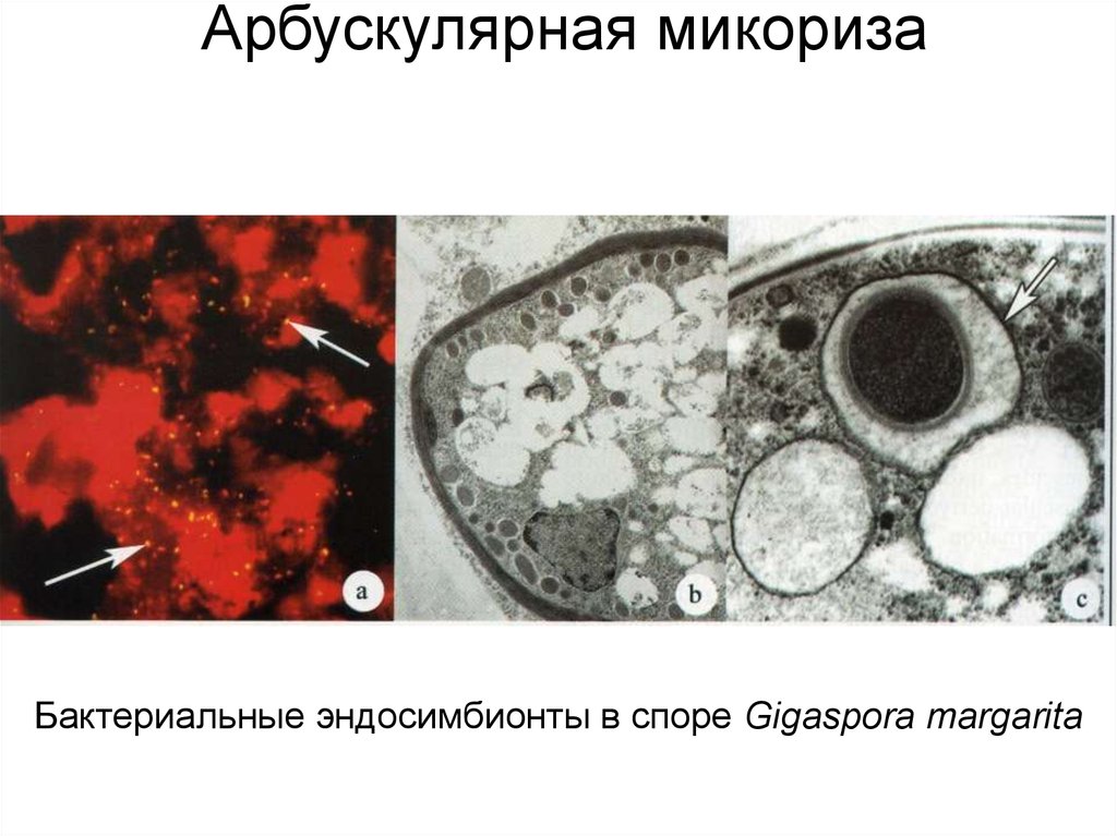 Арбускулярная микориза. Везикулярно-арбускулярная микориза. Эндотрофная микориза. Арбускулярные микоризные грибы. Арбускулярная микориза под микроскопом.