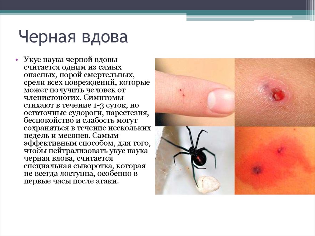 Черная вдова