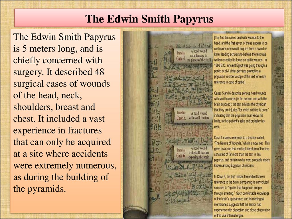 Science Source Edwin Smith Papyrus 1500 Bc