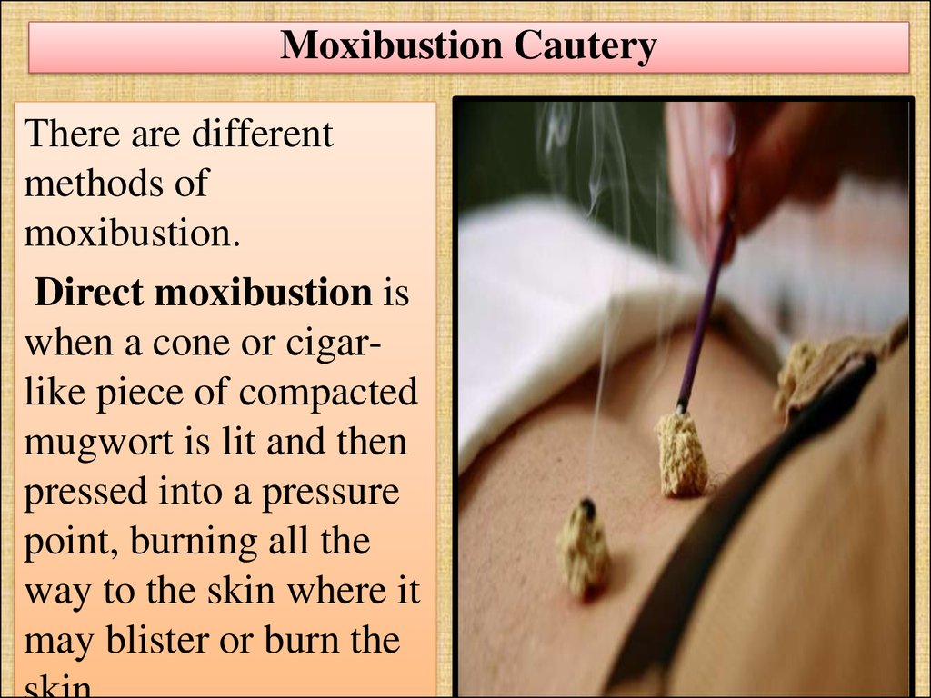 Moxibustion Cautery