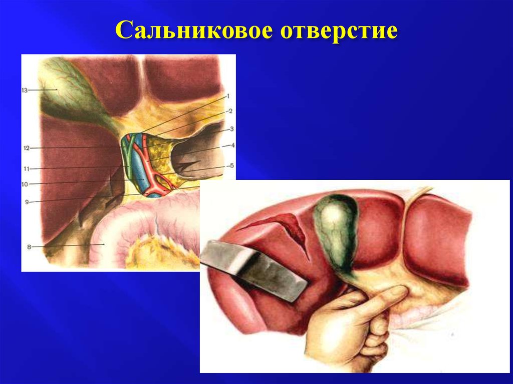 Стенки отверстия. Сальниковое винслово отверстие. Сальниковое отверстие снизу ограничено:. Сальниковое отверстие ограничено спереди. Топография сальникового отверстия.