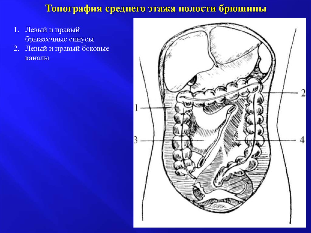 Полость свободно. Этажи полости брюшины топографическая анатомия. Правый и левый боковой канал брюшины. Топографические образования Нижнего этажа брюшинной полости. Средний этаж брюшинной полости.