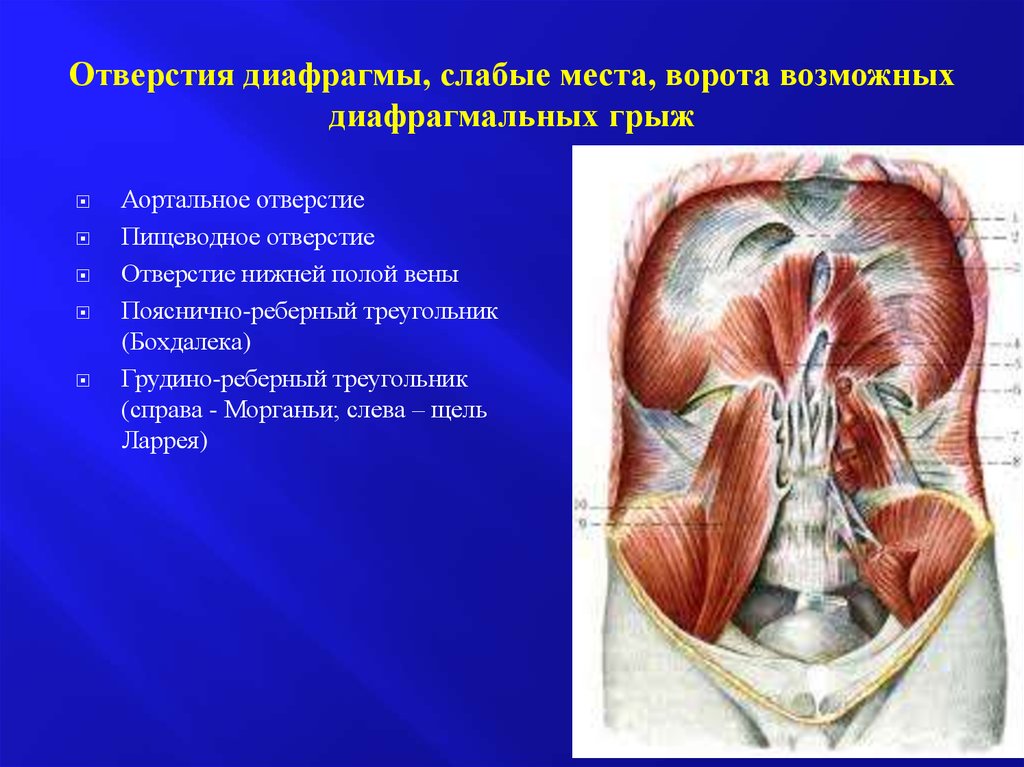 Центр диафрагмы. Грыжи диафрагмы Бохдалека. Пояснично реберный треугольник диафрагмы. Грудино реберный треугольник диафрагмы.