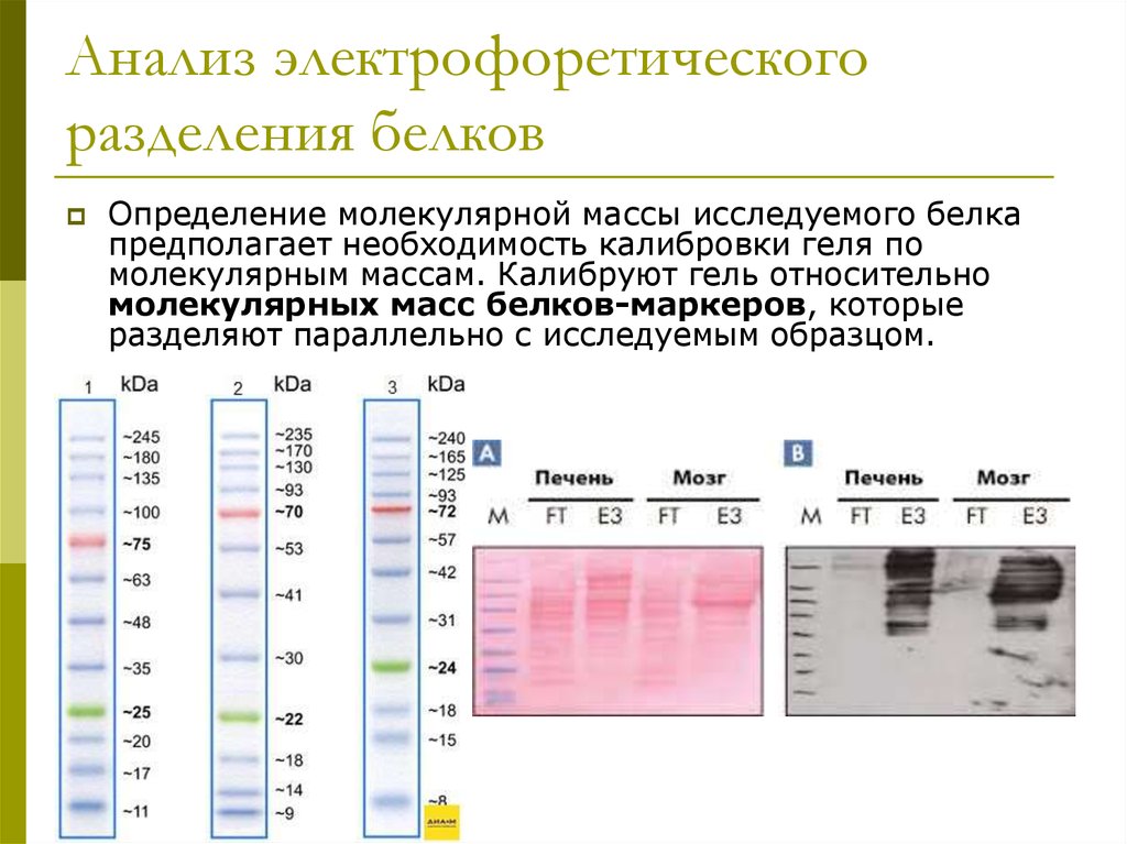 Белки методы определения белков. Разделение белков разной массы методом электрофореза. Схема электрофоретического разделения белков сыворотки. Молекулярная масса белков определение. Электрофоретического исследования белков.