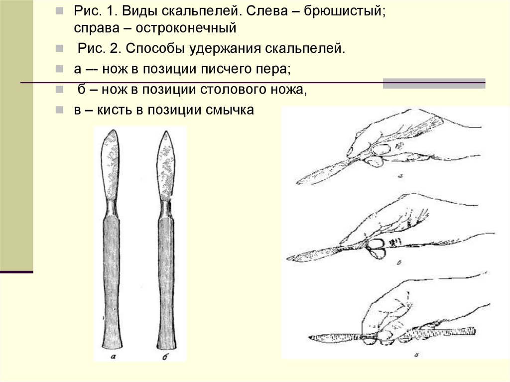 Длина скальпеля. Скальпель брюшистый Назначение. Скальпели хирургические классификация. Строение хирургического ножа. Типы скальпелей хирургических.