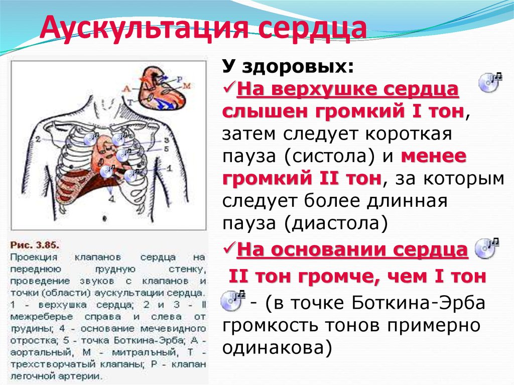 Аорта выслушивается. 1 Тон при аускультации сердца. Тоны сердца в норме при аускультации. Тоны сердца у детей и точки аускультации. Точки аускультации сердца пропедевтика внутренних болезней.