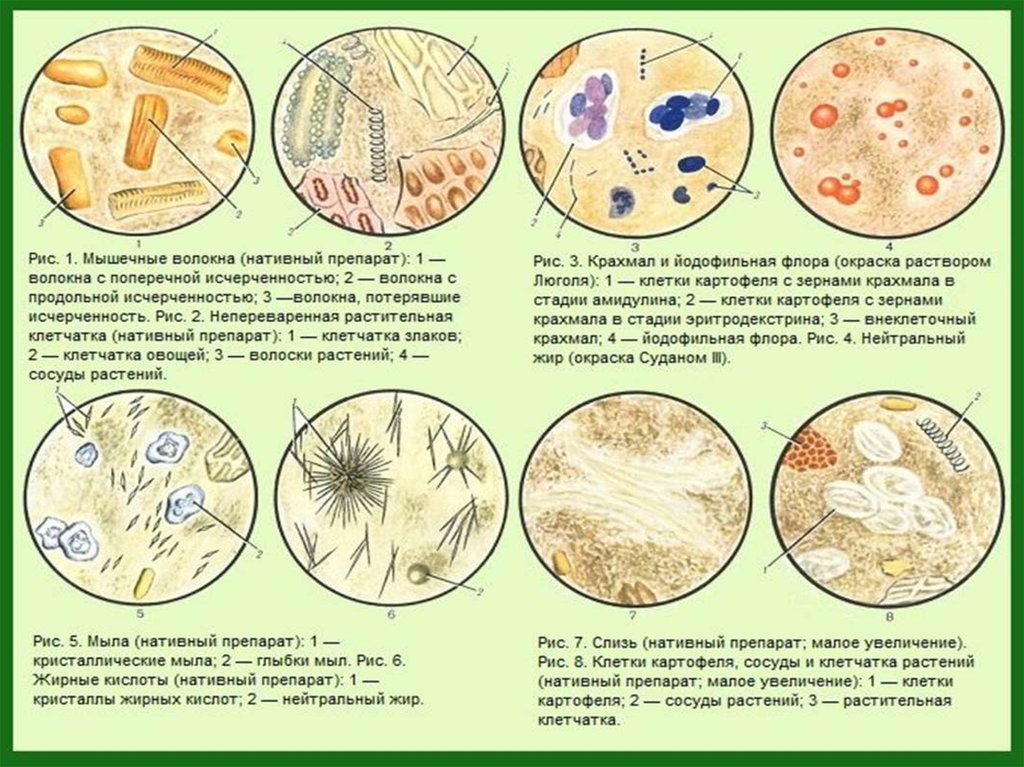 Сколько человек в кале. Микроскопия кала растительная клетчатка непереваримая. Копрологическое исследование микроскопия препаратов кала. Атлас копрограмма микроскопия. Микроскопия нативного препарата кала.