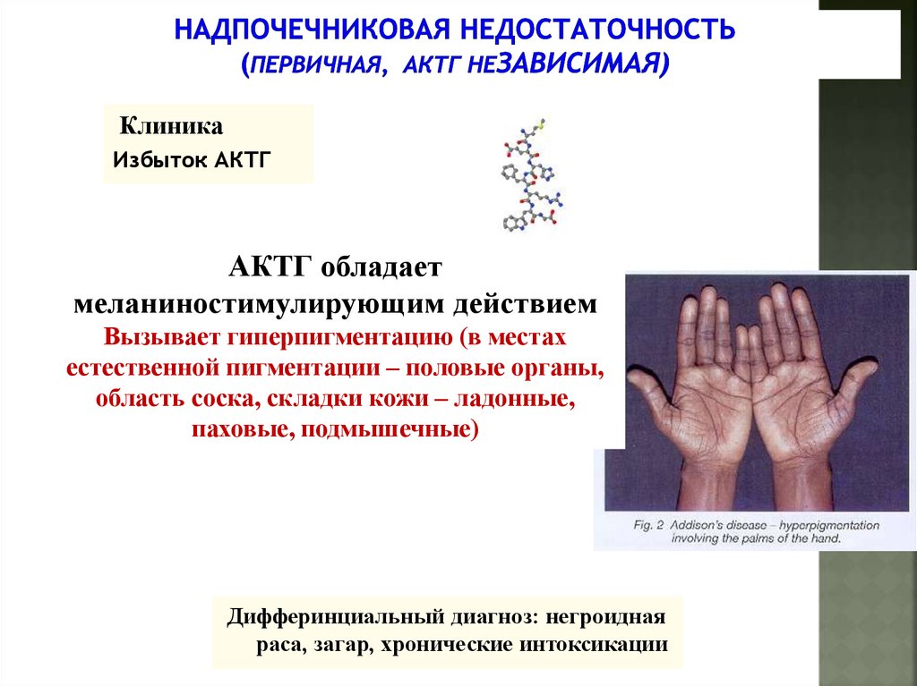 Недостаточность надпочечников презентация