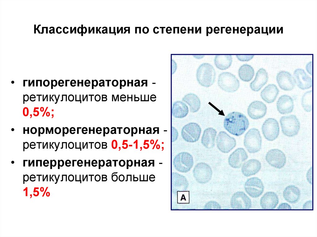 Презентации по гематологии