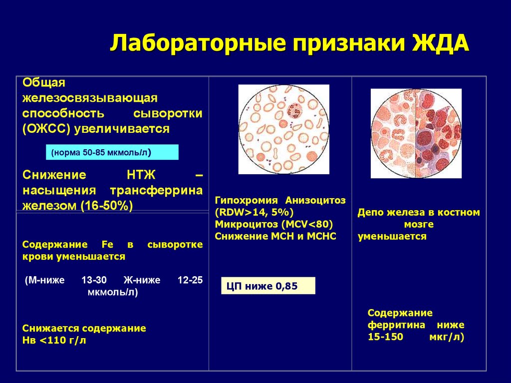 Гипохромия железодефицитная анемия