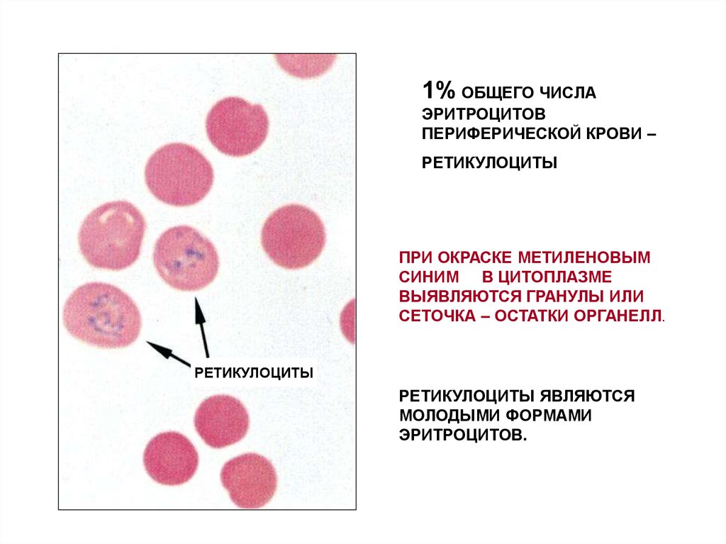 Тельце гейнца. Ретикулоциты в периферической крови. Ретикулоциты в периферической крови в норме. Норма ретикулоцитов в периферической крови. Нормальные показатели ретикулоцитов периферической крови в %.