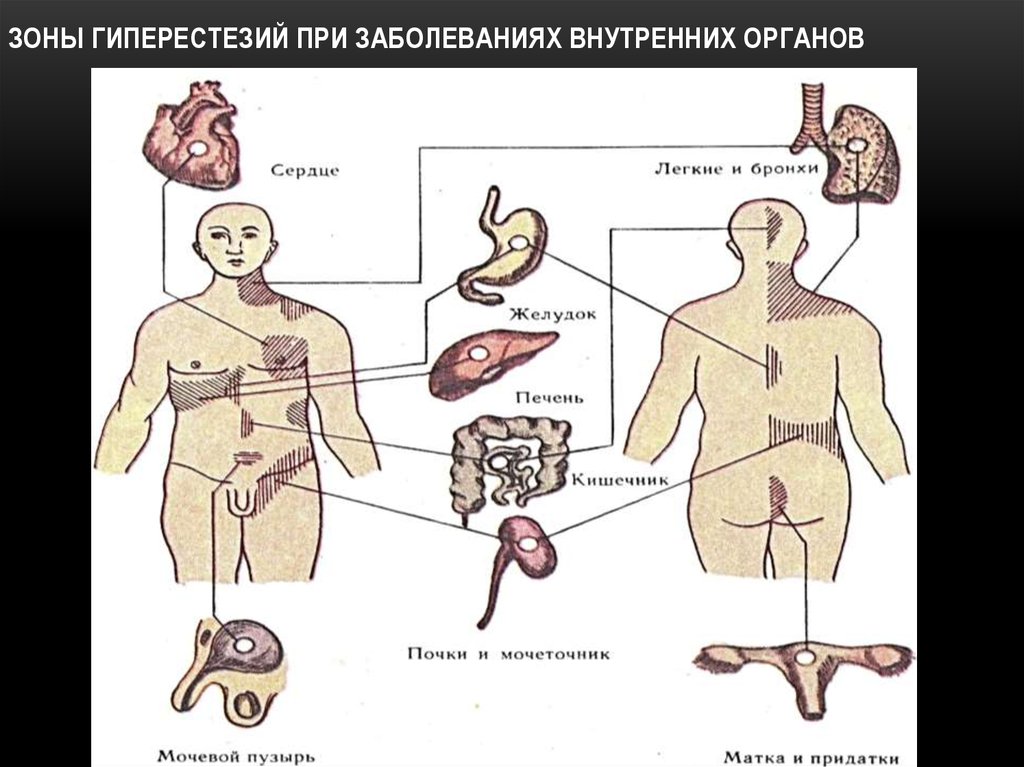 Болезни внутренних органов. Заболевания внутренних органов. Хронические заболевания внутренних органов. Поражения кожи при болезнях внутренних органов. Воспаление внутренних органов.